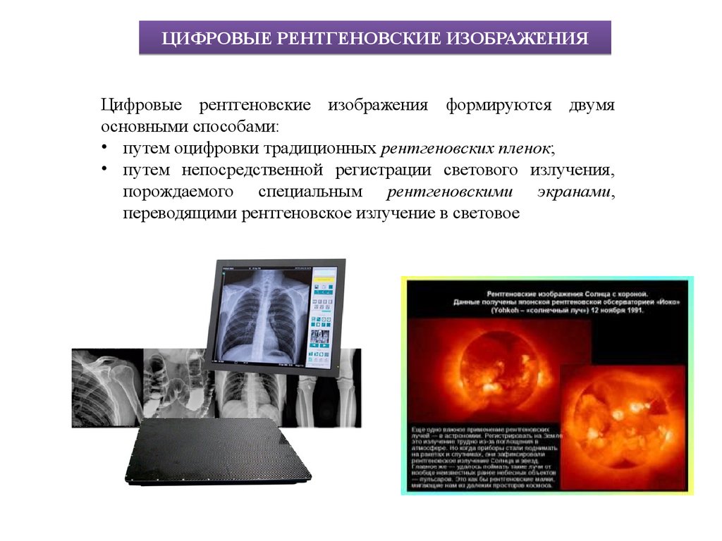 Свойства рентгеновского изображения