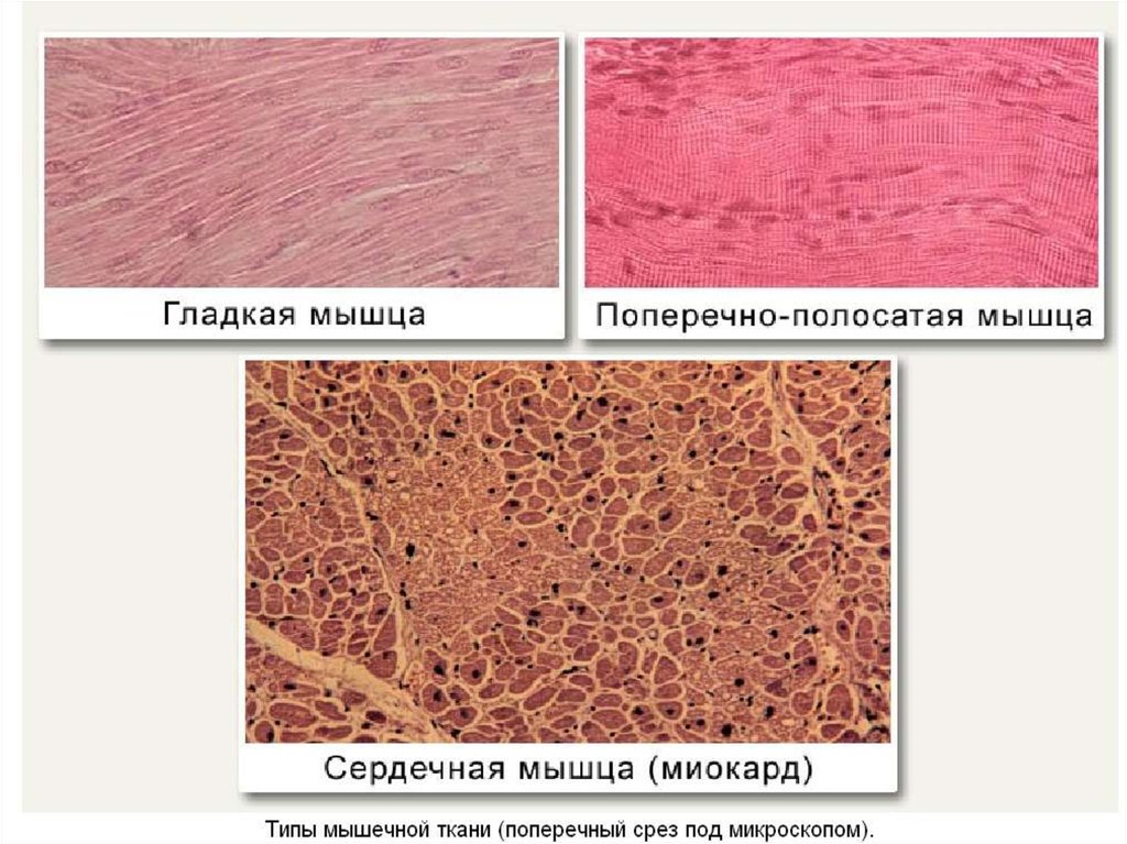 Тканей результате. Гладкая мышечная ткань поперечный срез. Поперечно полосатая и гладкая мышечная ткань сравнение. Гидропрепаровка тканей это. Отличие гладкомышечной ткани от поперечно-полосатой.