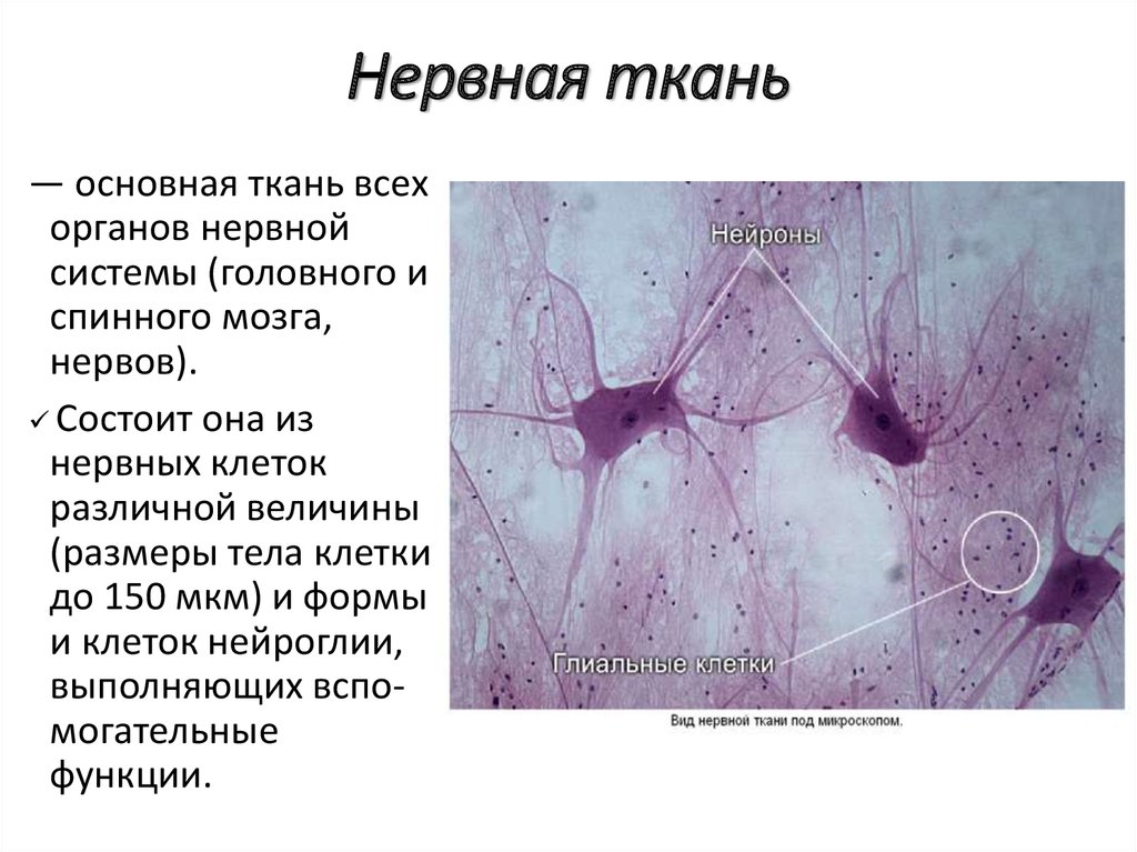 Нейроны спинного мозга характеристика. Нервная ткань гистология препараты. Нейроглия гистология препарат. Микропрепарат нервной ткани строение. Нервные клетки гистология препарат.