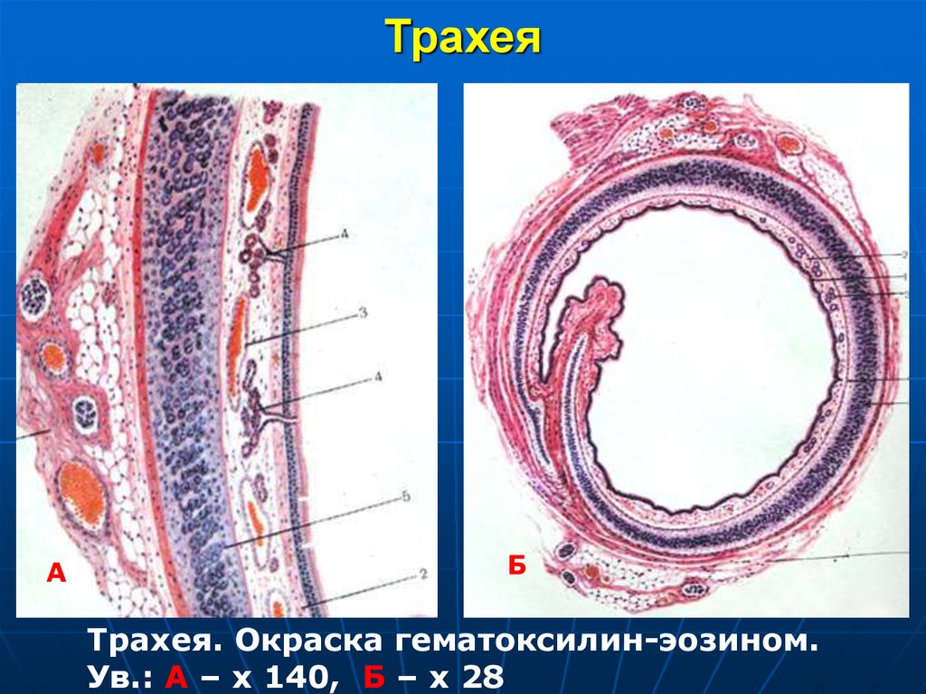 Трахея ткани. Трахея срез гистологический. Поперечный срез стенки трахеи. Трахея гистология препарат. Стенка тоахеи шистологич.