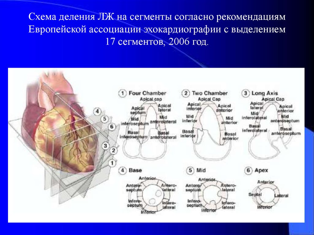 Локальная сократимость левого желудочка. Сегменты миокарда на ЭХОКГ. Сегменты левого желудочка ЭХОКГ схема. Сегменты левого желудочка на ЭХОКГ. Деление миокарда на сегменты.