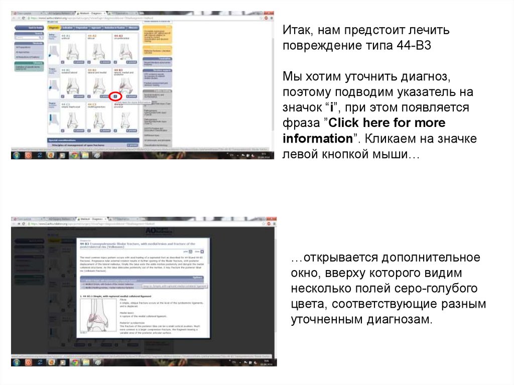 Итак, нам предстоит лечить повреждение типа 44-В3 Мы хотим уточнить диагноз, поэтому подводим указатель на значок “i”, при этом появляется ф