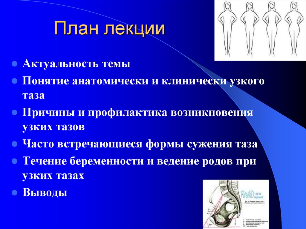 Узкий таз презентация по акушерству