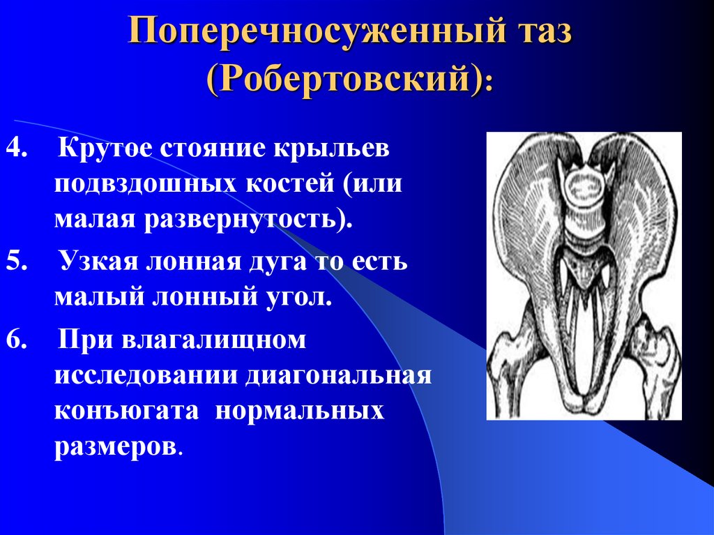 Аномалии таза презентация