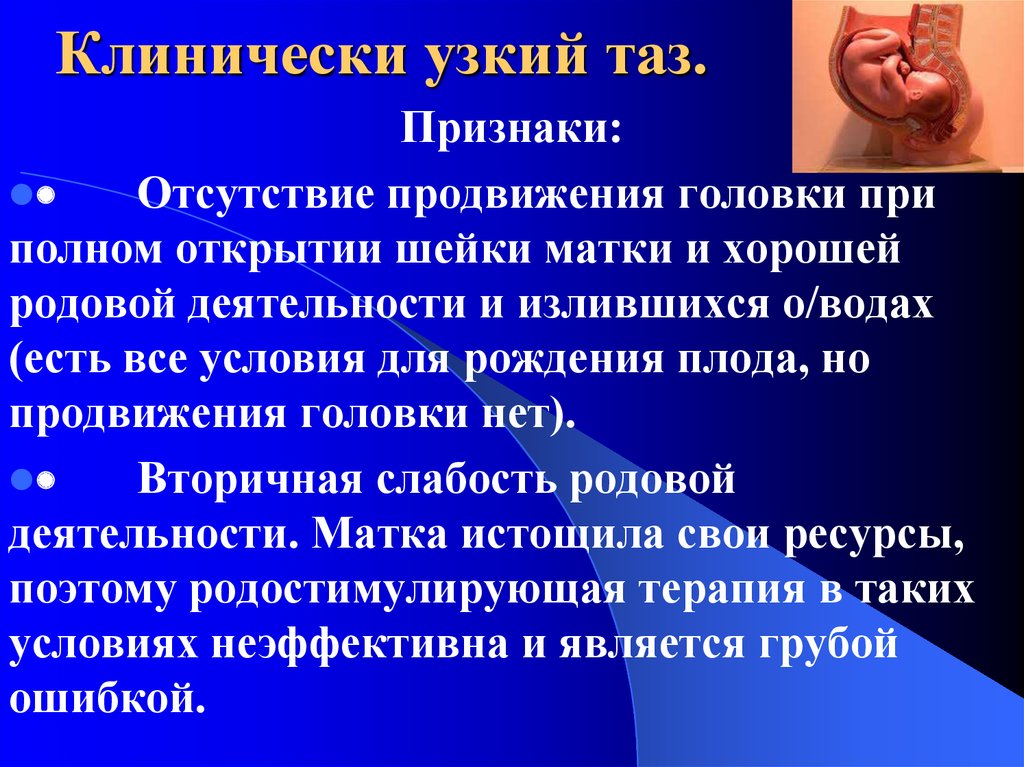 Анатомический узкий таз в акушерстве презентация