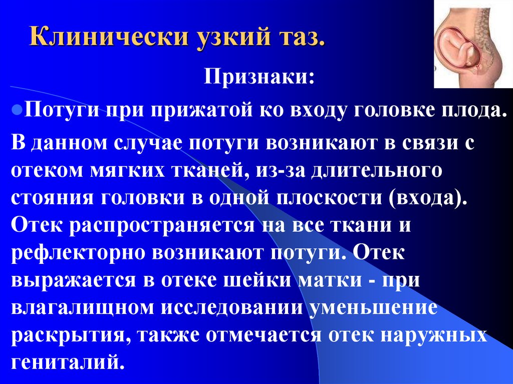 Узкий таз презентация по акушерству