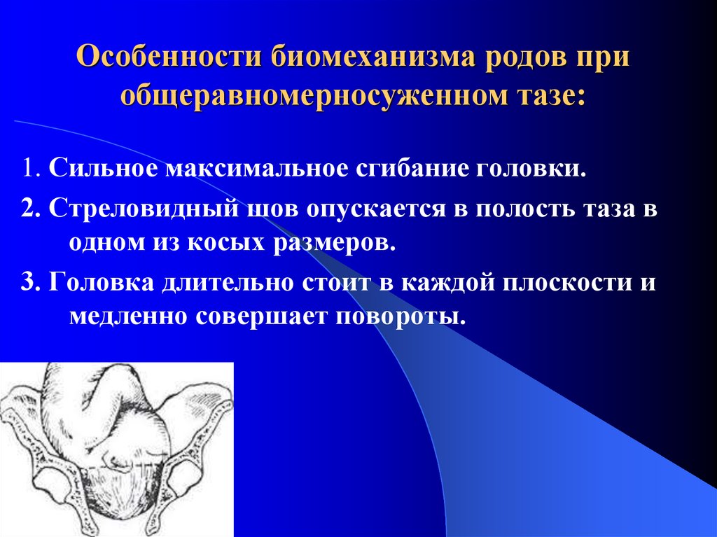 Бишопу акушерство. Механизм родов при общеравномерносуженном тазе. Биомеханизм общеравномерносуженном тазе. Биомеханизм родов при общеравномерносуженном тазе. Особенности биомеханизма родов.