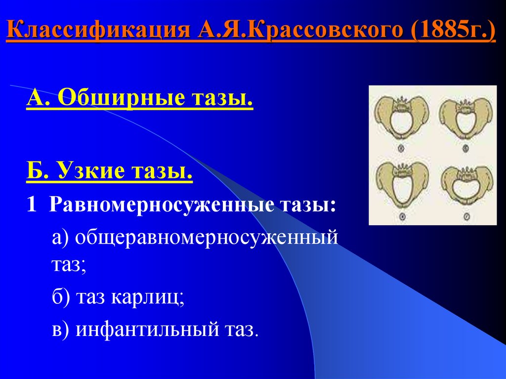 Узкий таз презентация по акушерству