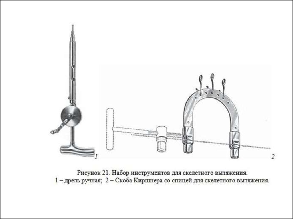 Инструменты для ампутации конечности. Инструменты для скелетного вытяжения. Спица Киршнера скелетное вытяжение. Инструменты для скелетного вытяжения операции на костях. Набор инструментов для скелетного вытяжения хирургия.