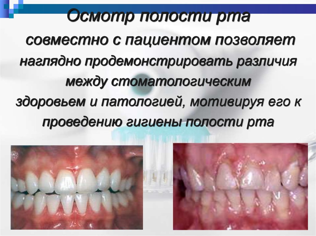 Осмотр полости рта совместно с пациентом позволяет наглядно продемонстрировать различия между стоматологическим здоровьем и патологией,