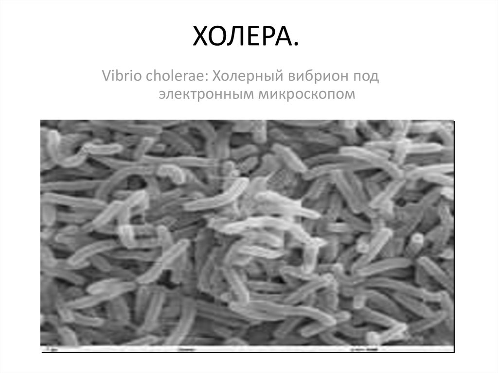 Виды холеры. Холерный вибрион электронная микроскопия. Вибрио холера морфология. Холерный вибрион под микроскопом. Холерный вибрион под электронным микроскопом.