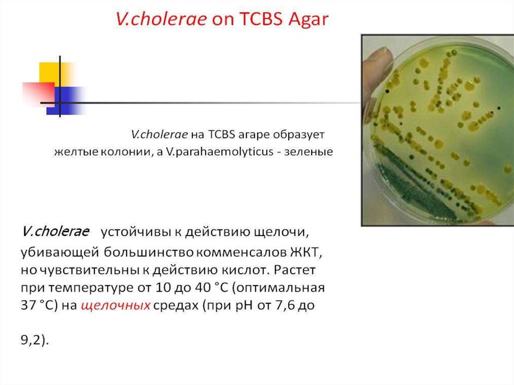 Холерный вибрион презентация микробиология