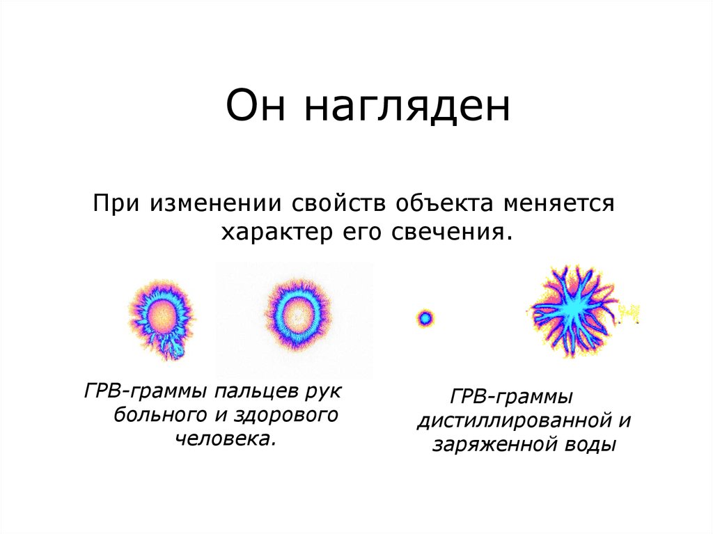 Грв. Грв грамма. Газоразрядная визуализация. Коротков газоразрядная визуализация метод грв. Грв-100 через.