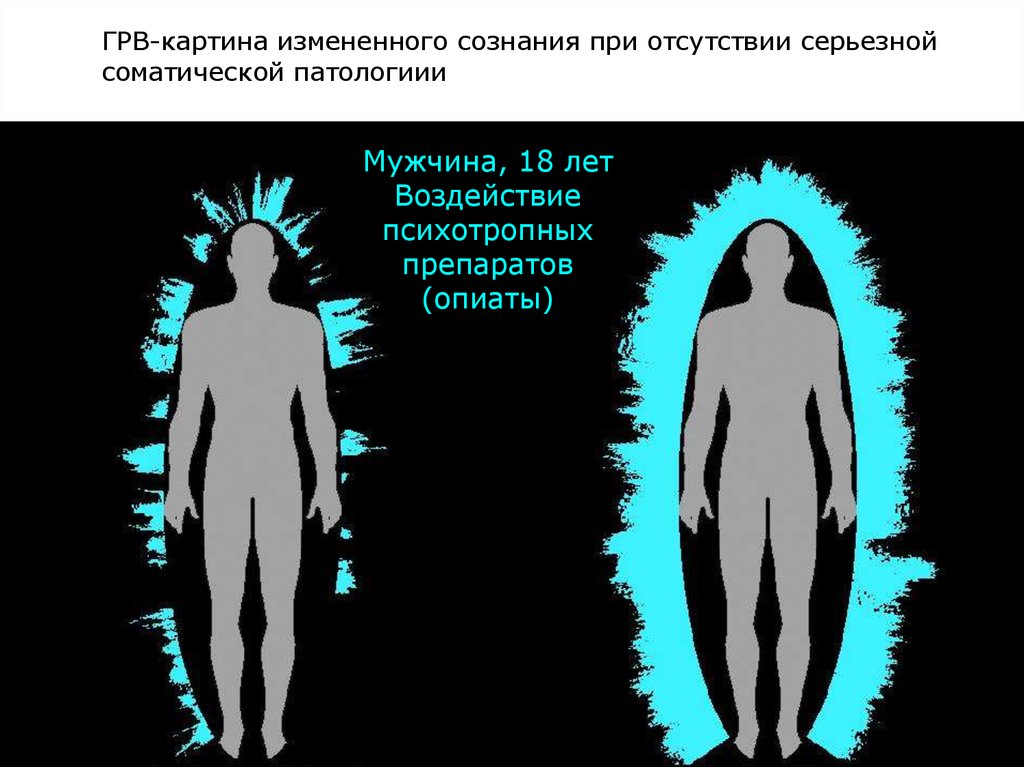 Изменяющие сознание. Изменение сознания. Газоразрядная визуализация. Психотехники для изменения сознания. Измененное состояние сознания картины.