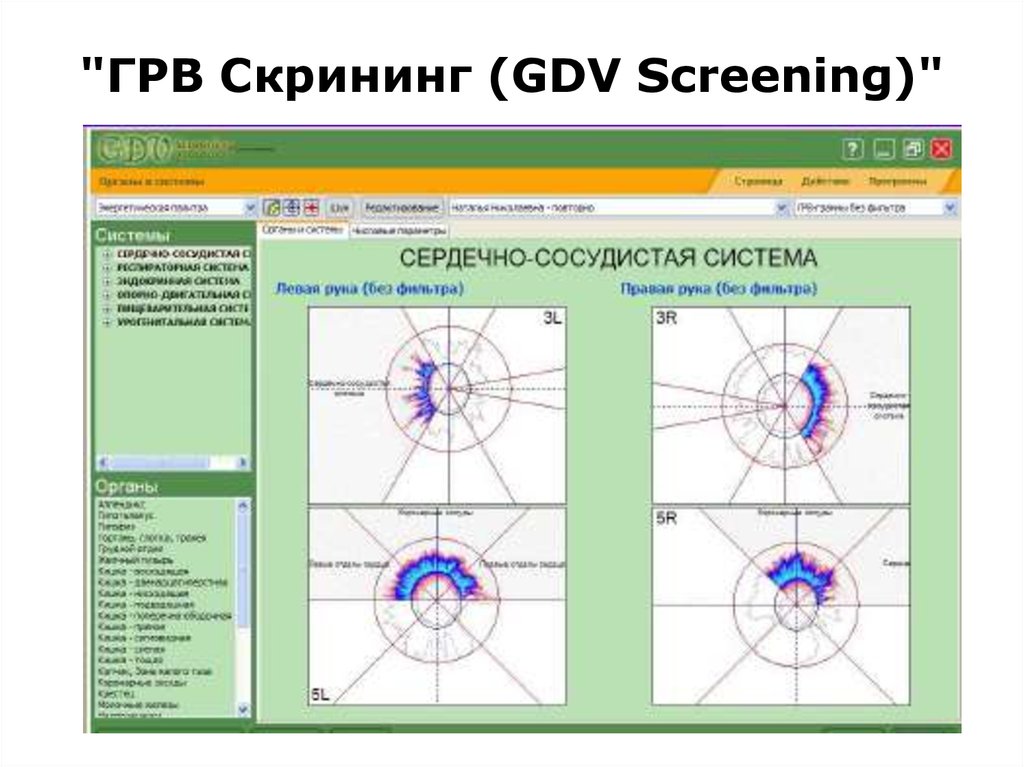 Грв. Газоразрядная визуализация. Коротков газоразрядная визуализация метод грв. GDV диагностика. Разрешение грв.