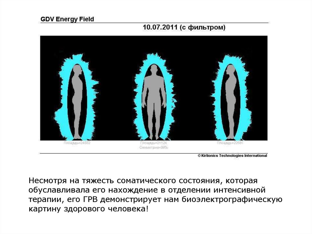 Особое состояние в которое впадает медиум. Тяжесть соматического состояния. Газоразрядная визуализация раствора. Газоразрядная визуализация Короткова. GDV Energy field.