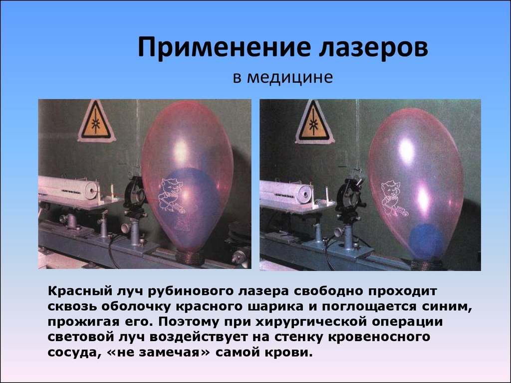 Применение лазера в косметологии презентация