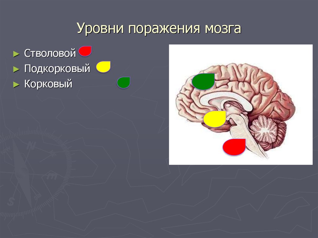 Поражения корково мозга. Дефицитарность подкорковых структур мозга. Функциональная дефицитарность подкорковых образований мозга.. Функциональная дефицитарность подкорковых ядер мозга..