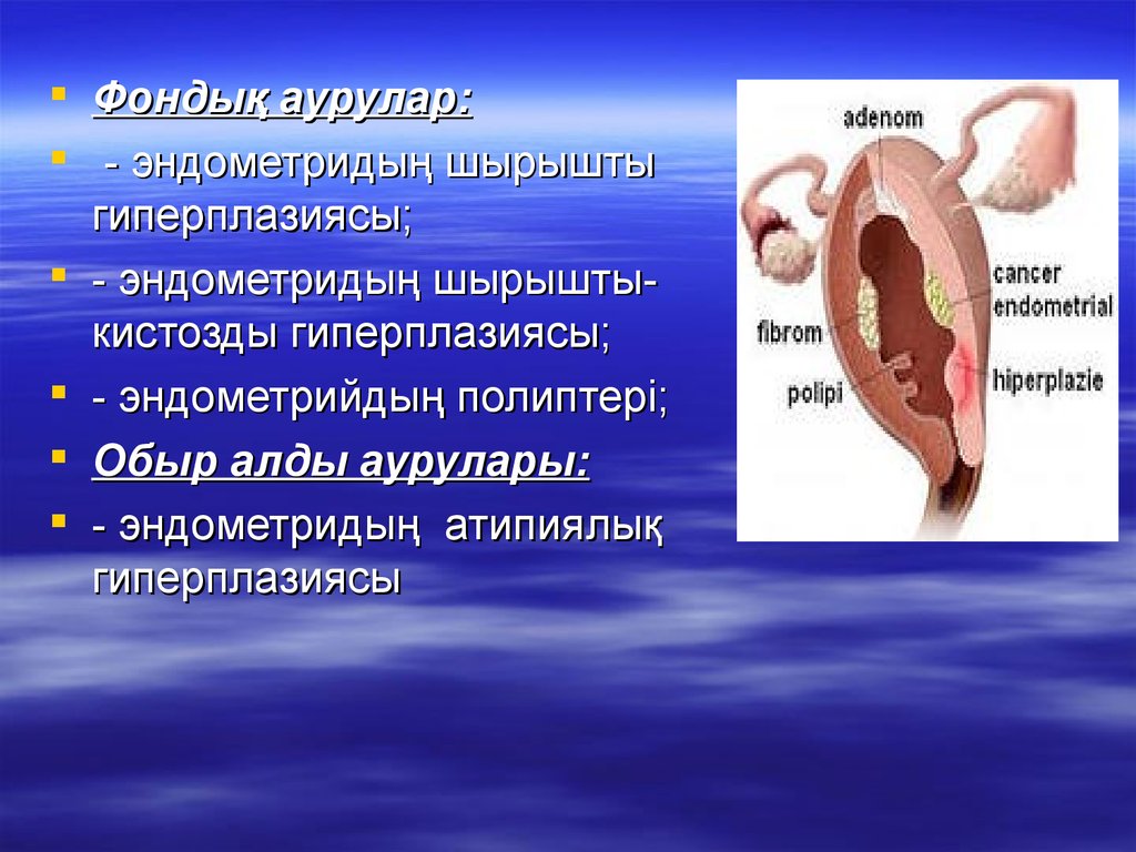 Предрак эндометрия. Фоновые и предраковые заболевания тела матки. Фоновые и предраковые процессы эндометрия. Предраковые процессы в теле матки. Железисто-кистозная гиперплазия эндометрия.