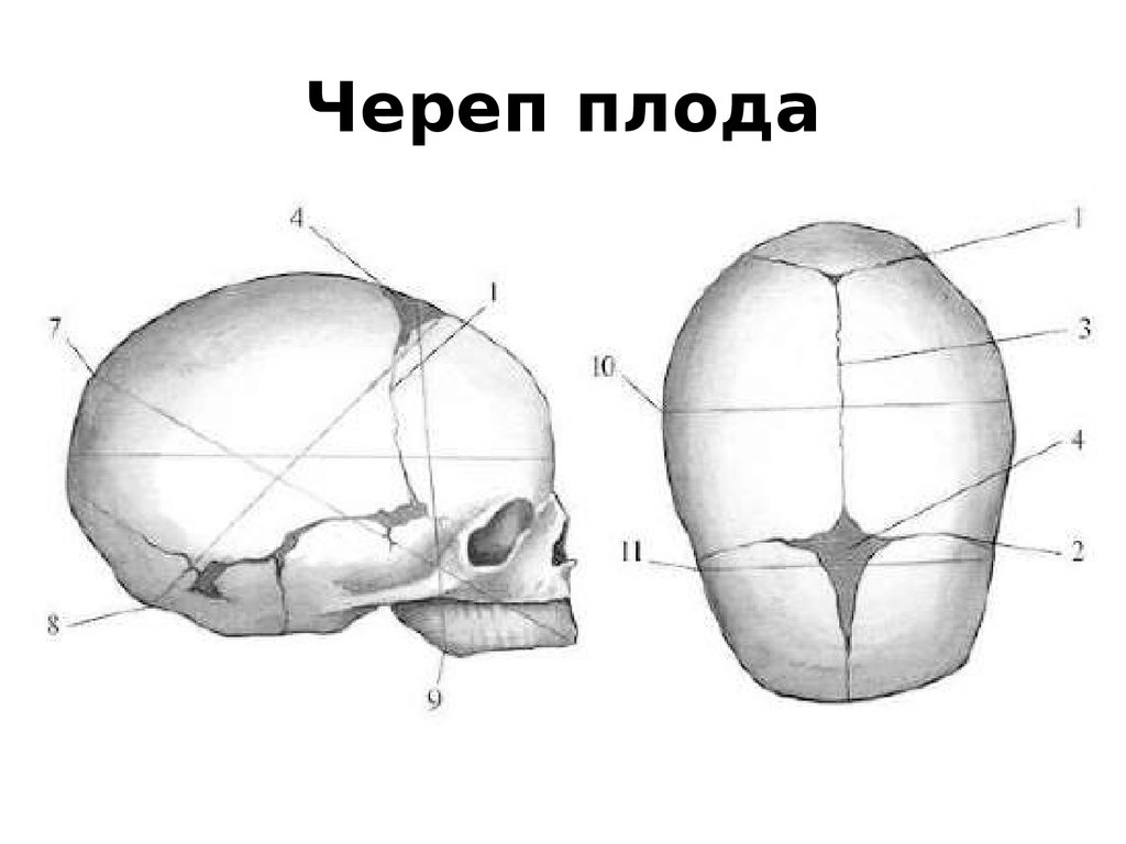 Роднички плода. Швы и роднички черепа анатомия. Строение черепа плода кости швы роднички. Роднички головки плода Акушерство. Роднички новорожденного анатомия черепа.