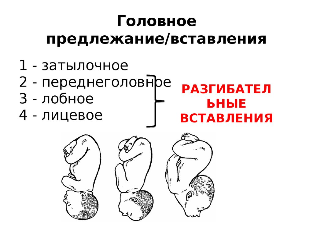 Виды затылочного предлежания. Положение плода головное затылочное. Головное предлежание плода задний вид. Головное предлежание 1 позиция задний вид. Головное предлежание затылочное вставление.