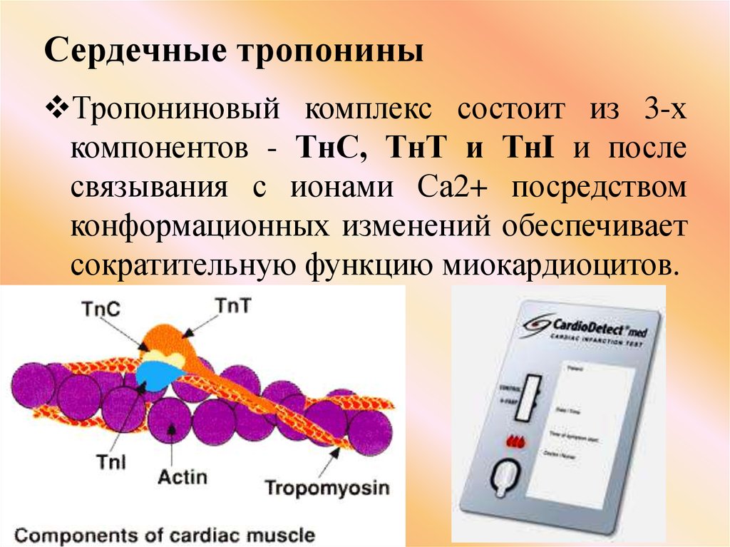 Тропонин анализ цена. Тропонин 1. Тропонин 1 экспресс. Анализ крови на тропонин т. Сердечный тропонин.