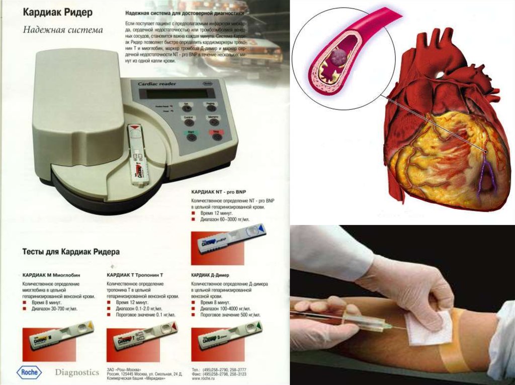 Диагностика заболеваний сердца. Аппарат Кардиак ридер. Аппарат Кардиак ридер для чего. Cardiac Combo инструкция. Cardiac paper Computer.