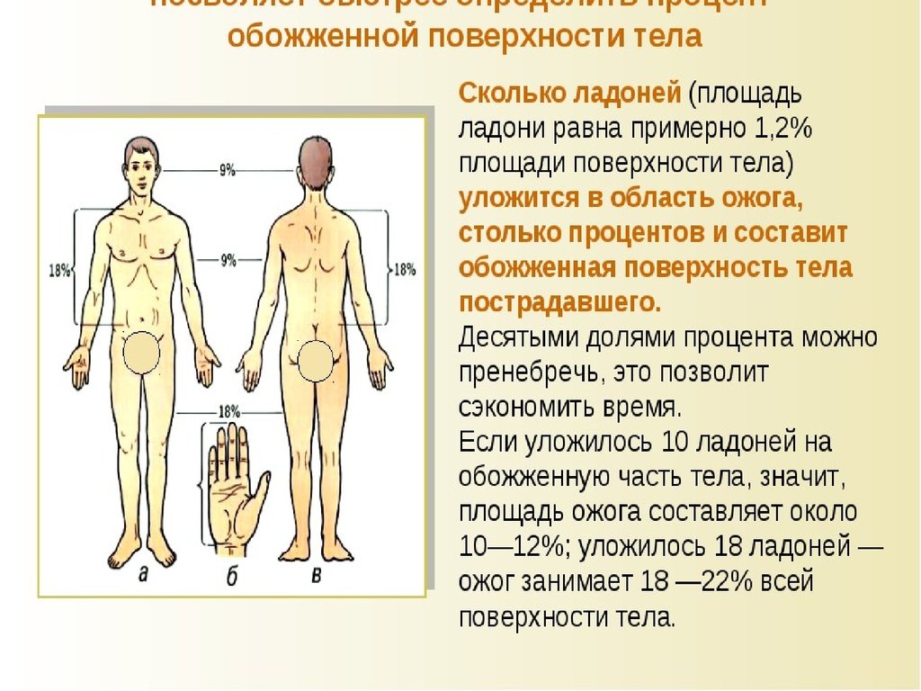 Процент поверхности тела. Площадь ожоговой поверхности. Площадь поражения при ожогах.