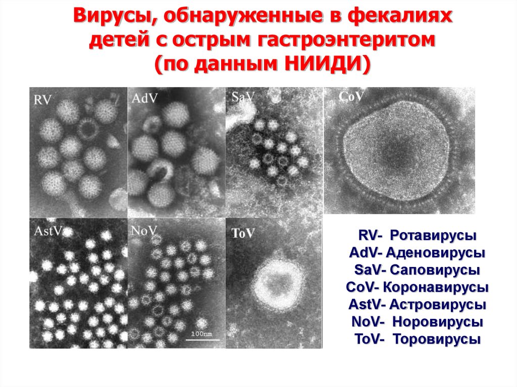 Ротавирус отличить. Аденовирус и ротавирус. Ротавирус классификация. Вирус ротавирус под микроскопом.