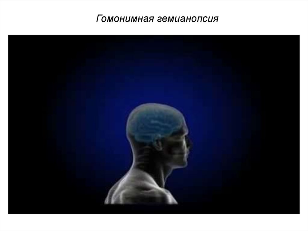 Сенсорные нарушения зрительного анализатора - презентация онлайн