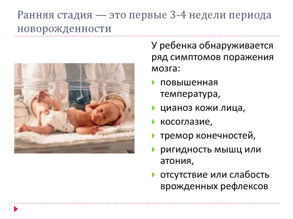 Недельный период. ДЦП симптомы у детей до 1 года признаки. ДЦП первые признаки у грудничка до года. Симптомы ДЦП У новорожденных в 1 месяц. Симптомы при ДЦП У ребенка 3 месяца.