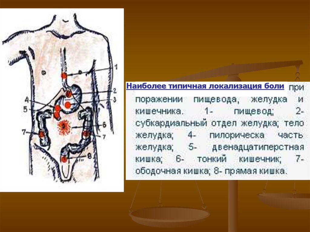 Заболевания локализация боли. Боль в желудке локализация. Локализация боли при заболеваниях ЖКТ.