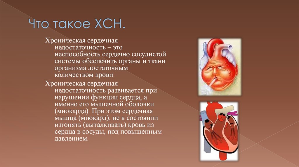 Заболевание сердца сопровождающееся сердечной недостаточностью. Хроническая сердечная недостаточность. Хроническая сердечная недостаточность ХСН это. Что такое ХСН В кардиологии. Хронические заболевания сердца.