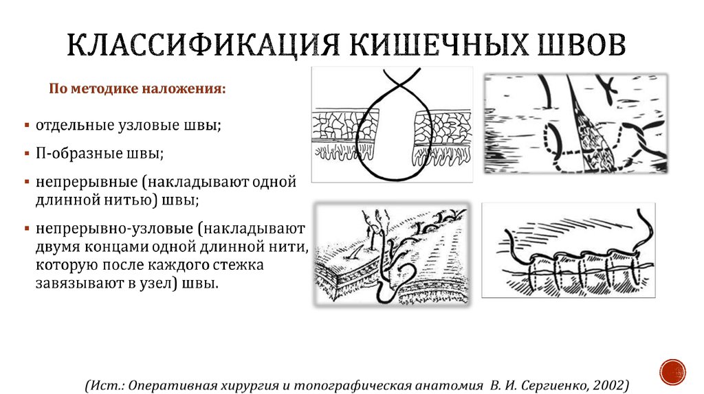 Виды хирургических швов презентация