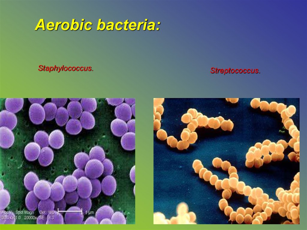 Бактерии staphylococcus aureus. Стафилококк стрептококк Протей. Микробы стафилококки стрептококк. Стафилококки стрептококки кишечная палочка. Пневмококк золотистый стафилококк.