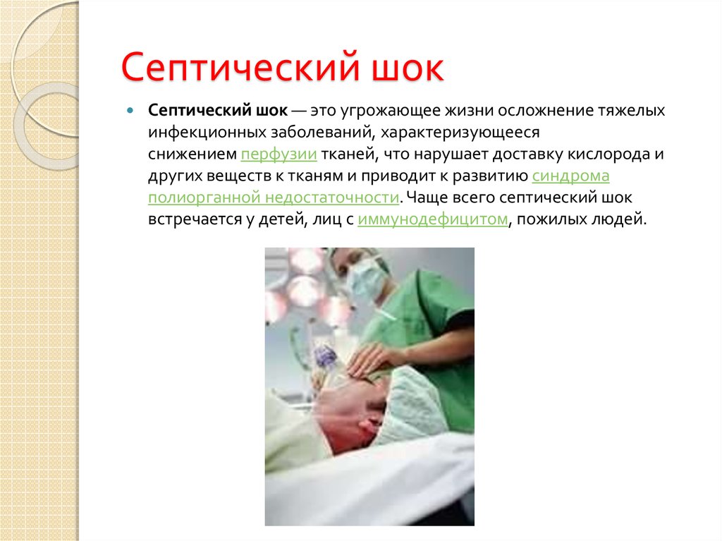 Септический шок