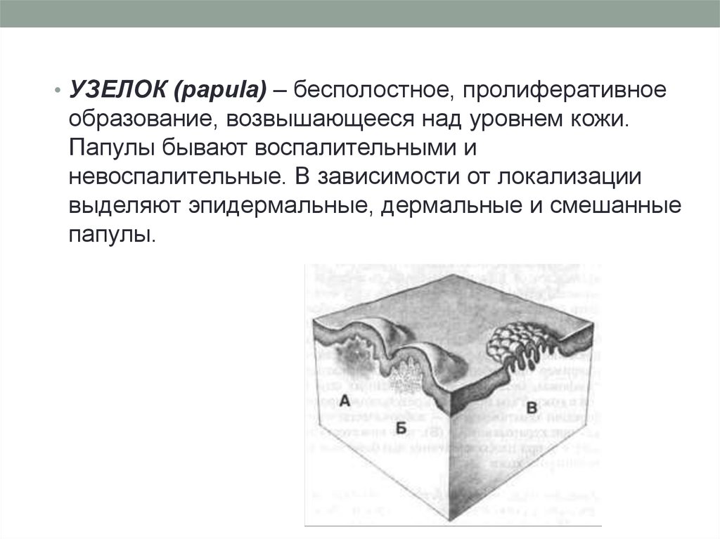 Первичные и вторичные элементы сыпи презентация