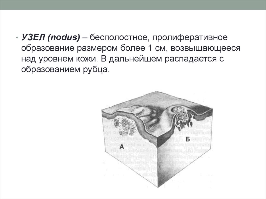 Элементы сыпи. Рубец морфологический элемент.