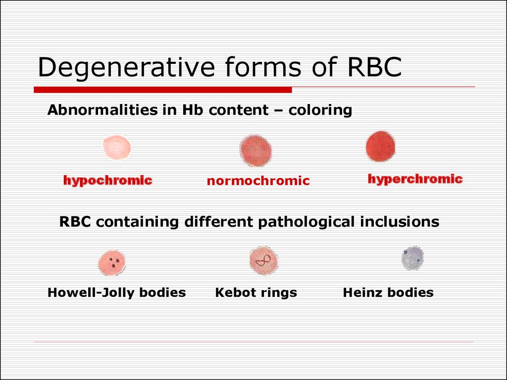 Degenerative forms of RBC