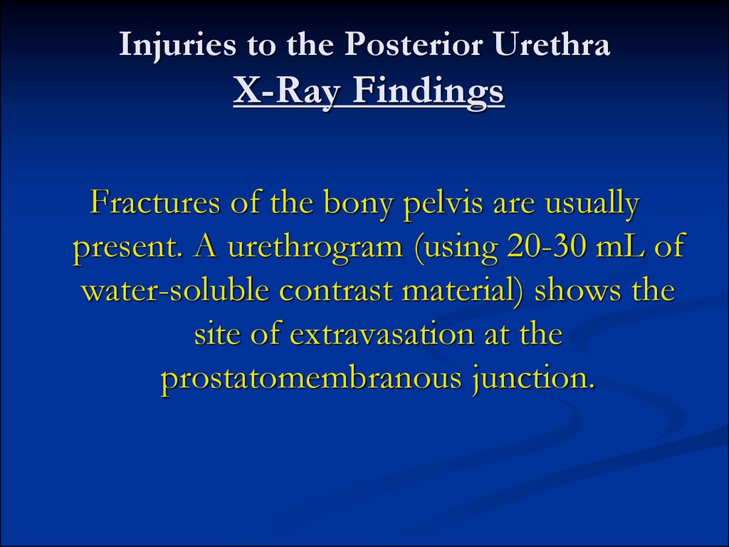 Injuries to the Posterior Urethra X-Ray Findings