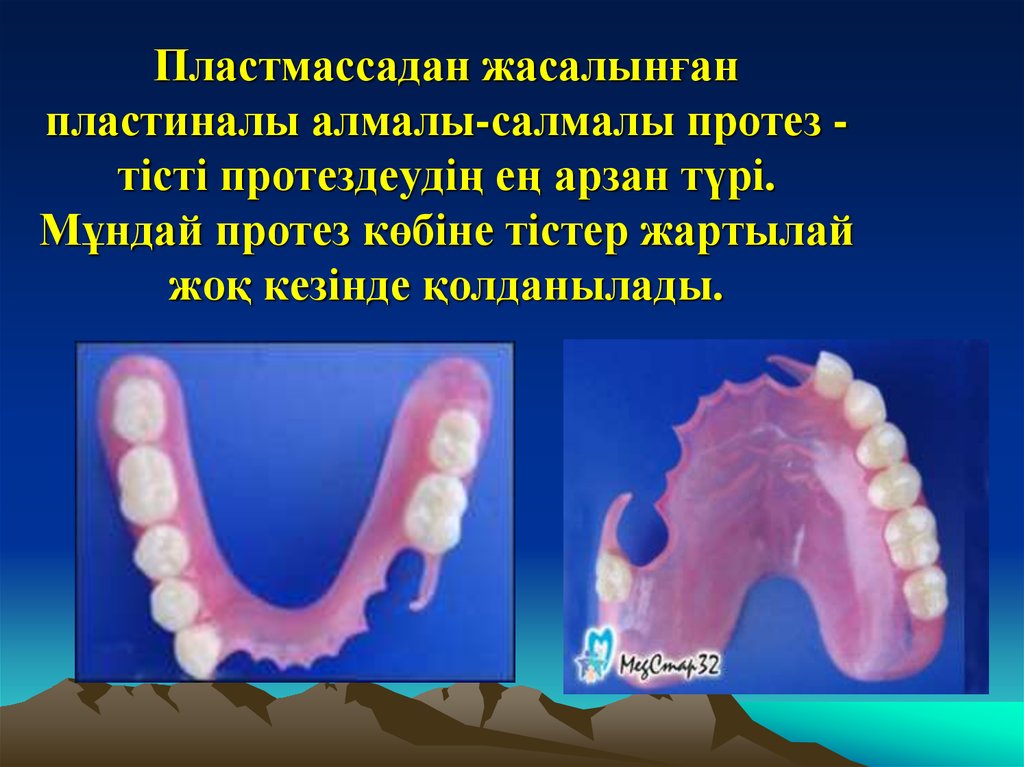 Протез презентация