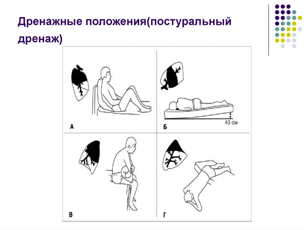 Постуральный дренаж картинка