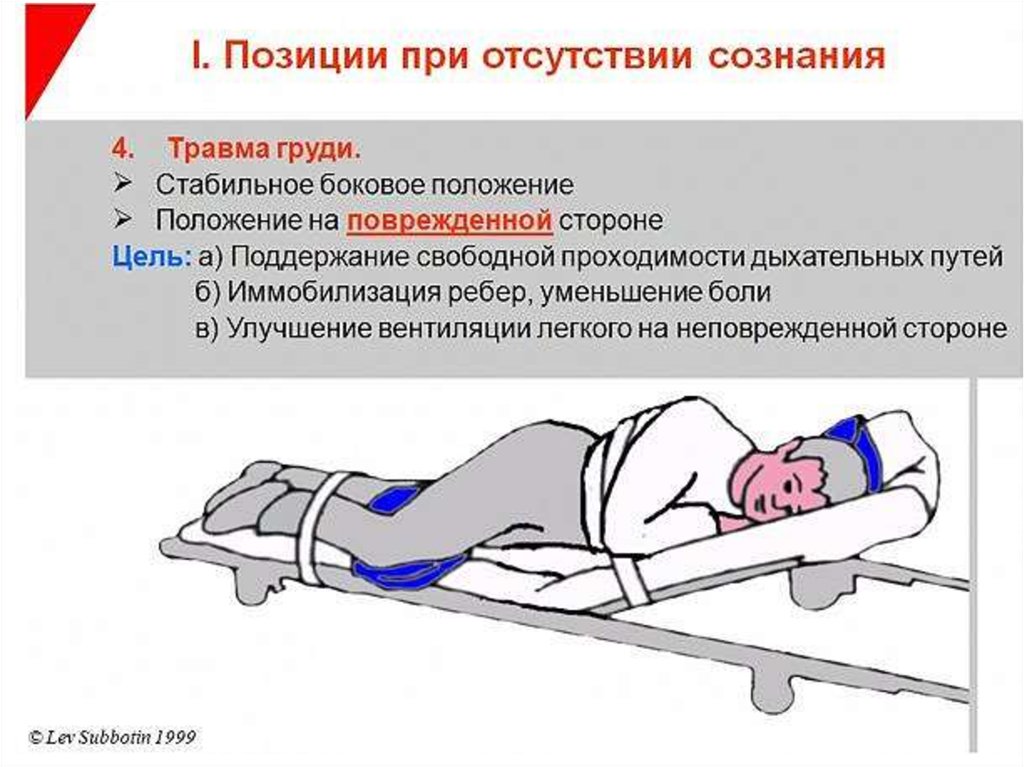 Транспортное положение. Транспортировка пострадавших положения пострадавшего. Перемещение пострадавшего с травмой грудной клетки. Транспортное положение пострадавшего при травме грудной клетки. Транспортировка пострадавших при повреждении грудной клетки.