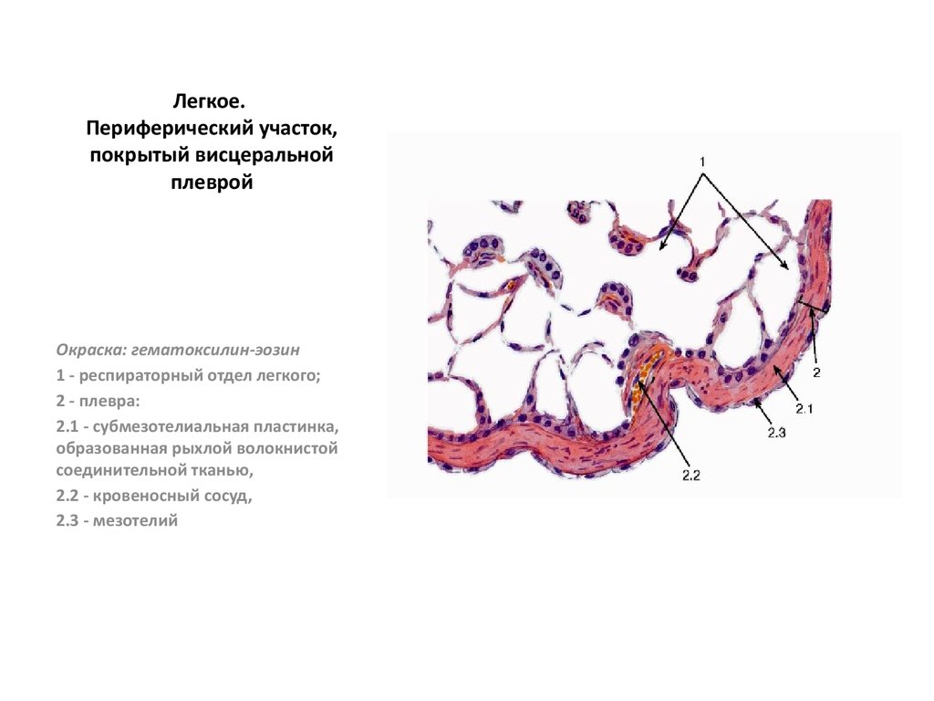 Слои легких. Плевра гистологическое строение. Строение плевры гистология. Висцеральный листок плевры гистология. Плевра гистология препарат.