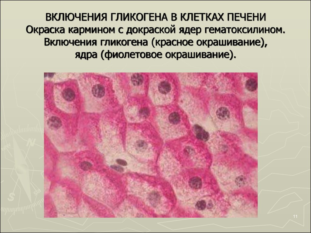 Печень аксолотля. Включения гликогена в печени аксолотля препарат. Включения гликогена в клетках печени аксолотля под микроскопом. Включения гликогена препарат гистология. Жировые включения в клетках печени аксолотля под микроскопом.
