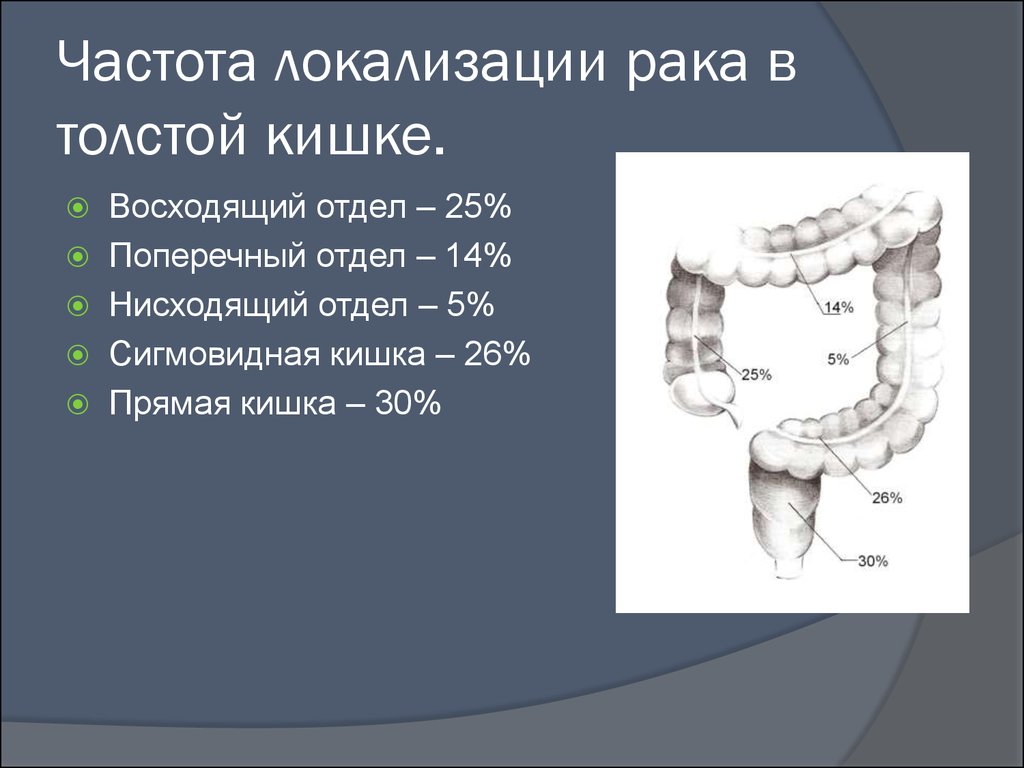 Рак желудка операции презентация