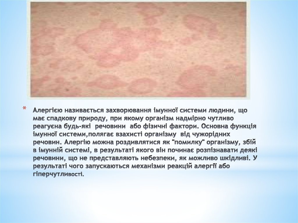 Алергією називається захворювання імунної системи людини, що має спадкову природу, при якому організм надмірно чутливо реагуєна будь-які 
