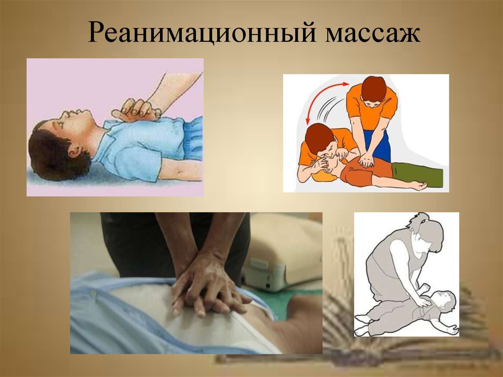 Жүрек өкпе реанимациясы презентация