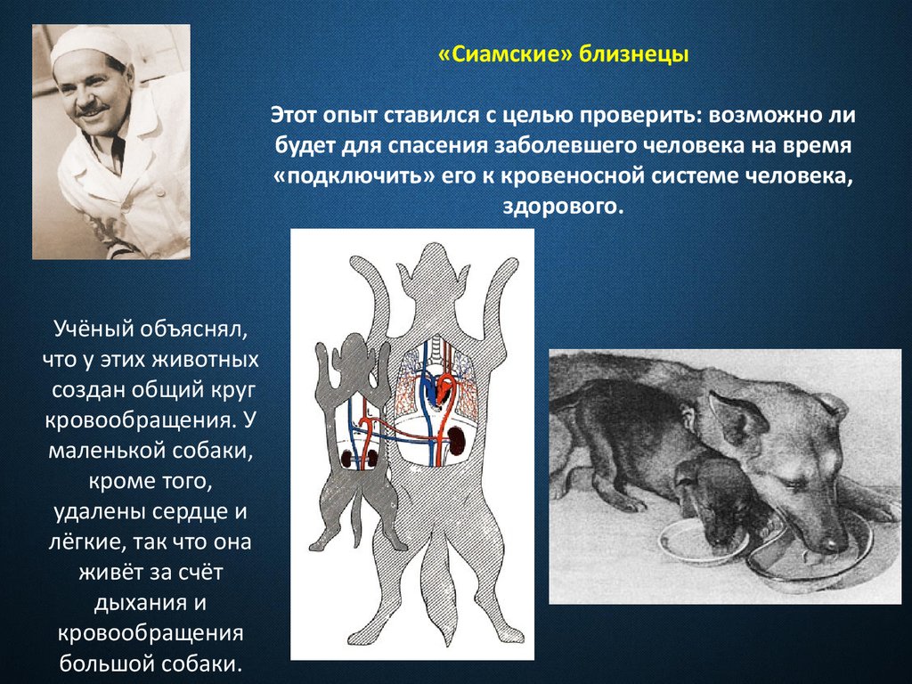 Сиамские близнецы презентация