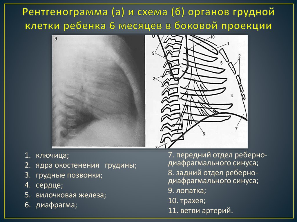 Изображение на рентгенограмме